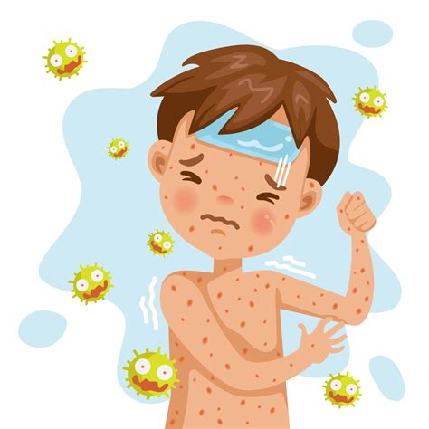 Signs and Symptoms of Chickenpox | What You Need to Know