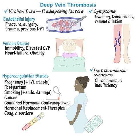 Pregnancy And Deep Vein Thrombosis - Deep Vein Thrombosis Dvt / Also ...