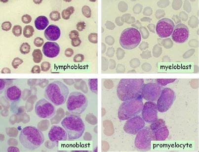 Different Blasts on a smear | Medical Laboratories