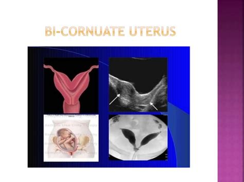 Ultrasound in Gynecology