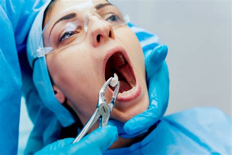 Tooth Extraction - The Process of Tooth Removal - Best Dentist in Toronto