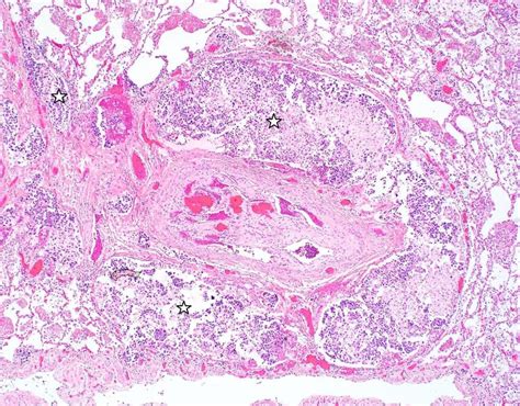 Pulmonary Artery Histology