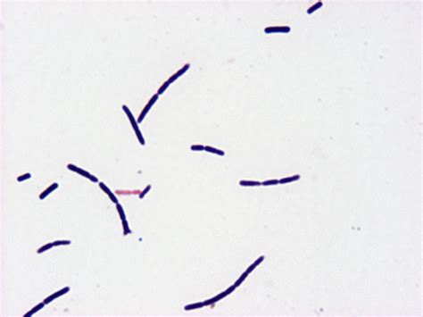 Lactobacillus Gram Stain