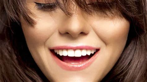 Want a Perfect Smile? 3 Things to Know About Veneers