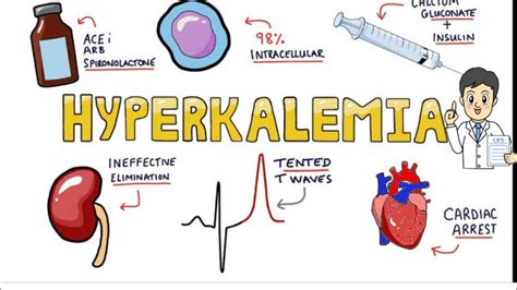 Hyperkalemia Symptoms Ekg