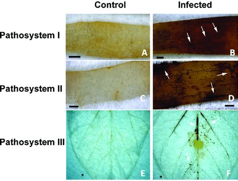 Microscopic detection of H 2 O 2 accumulation using DAB staining during ...