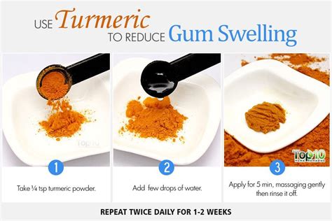 Home Remedies to Reduce Gum Swelling | Top 10 Home Remedies | Swollen ...