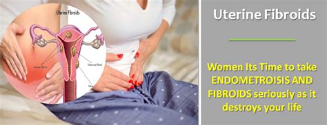 Uterine Fibroids - Indian Med Guru Blog