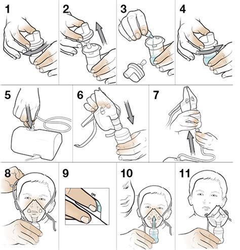 How to Use A Nebulizer On A Child Step By Step – SmartMommies