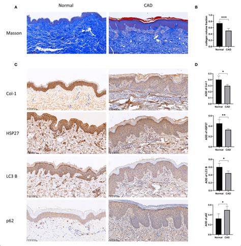 | Histopathological results of the skin of normal and photoaged groups ...