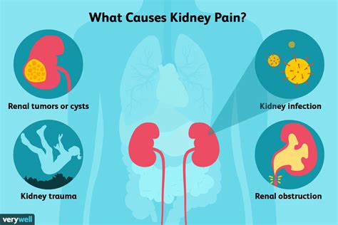 When to See a Healthcare Provider About Kidney Pain (2024)