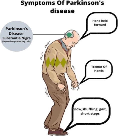 Symptoms of Parkinson’s disease | Download Scientific Diagram