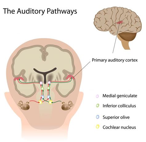 What is the Auditory System? (with pictures)