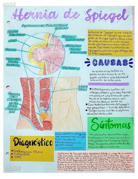 Hernia de Spiegel | AMY NJ | uDocz