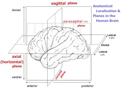 Identification of anatomical planes applied to brain Diagram | Quizlet