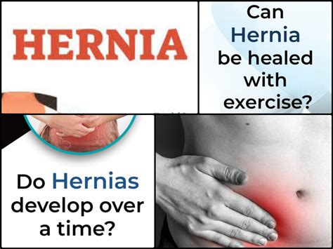 Hernia Types Causes Symptoms Diagnosis Treatment | Porn Sex Picture