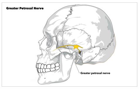 Anatomy, Head and Neck: Greater Petrosal Nerve - StatPearls - NCBI ...