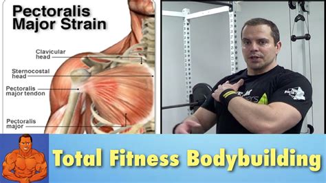 Pulled Chest Muscle - rehab exercises to speed recovery - YouTube