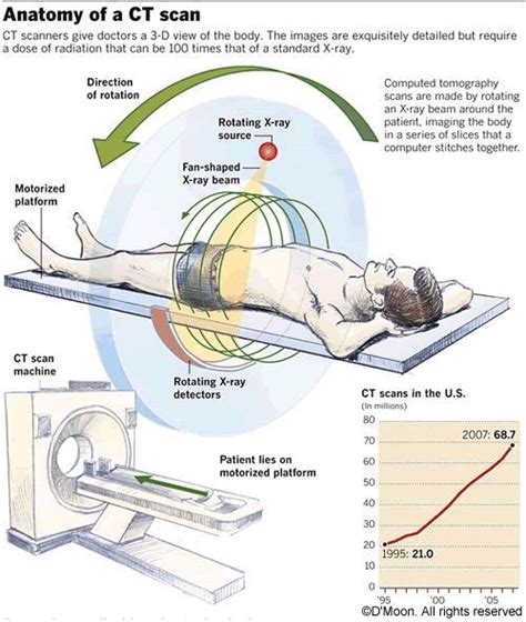 CT Scan | Medical radiation technologist, Radiology, Diagnostic imaging