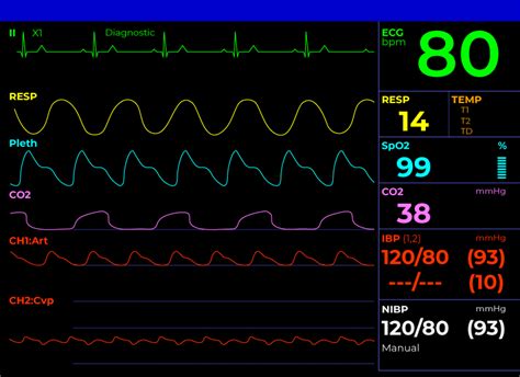 How To Read A Hospital Monitor: Understanding Vital Signs, 53% OFF