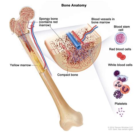 Myelofibrosis