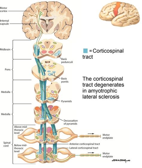 Corticospinal tract (blue) conveying motor signals from motor cortex to ...