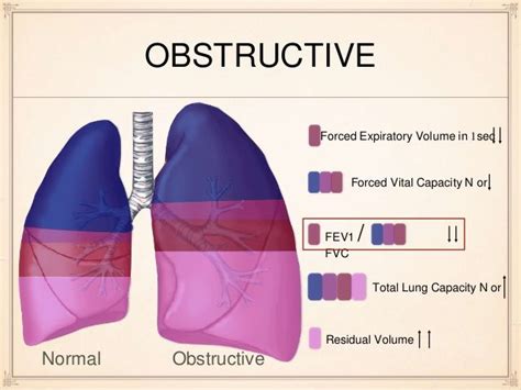 pulmonary function test results obstructive restrictive normal - Google ...