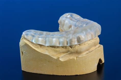 Occlusal Splints - Smileon Perth