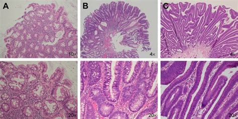 Photomicrographs (hematoxylin & eosin stain) of different types of ...