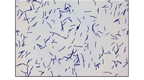 Microscopic view of showed gram positive rod shaped Lactobacillus ...