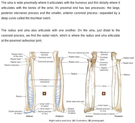 What is the difference between sigmoid notch and radial notch?