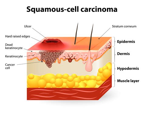 Is wearing sunscreen bad for us? | SiOWfa16: Science in Our World ...