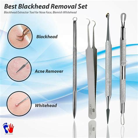 BLACKHEAD REMOVER TOOL KIT SPOT ACNE PIMPLE COMEDONE TWEEZERS EXTRACTOR ...