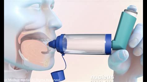 How to Use a Metered Dose Inhaler with a Spacer - YouTube