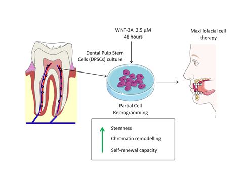 Cells | Free Full-Text | Wnt-3a Induces Epigenetic Remodeling in Human ...