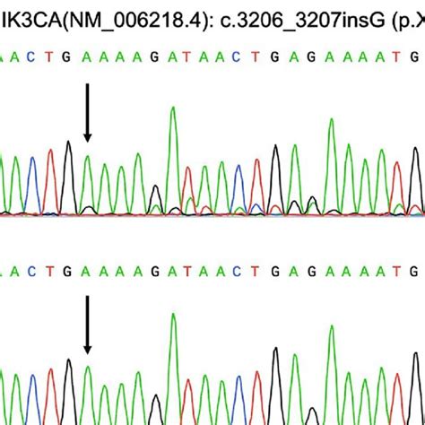 Sequencing results of the patient. a Mosaic PIK3CA mutation of ...