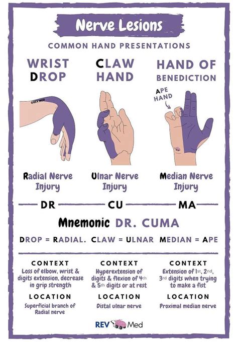 Ape Hand Median Nerve Palsy