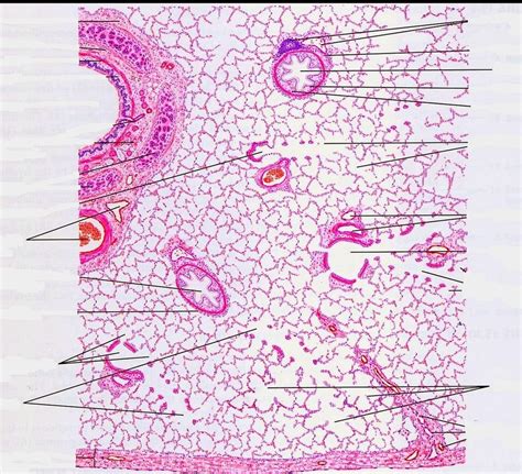 Pulmonary Artery Histology