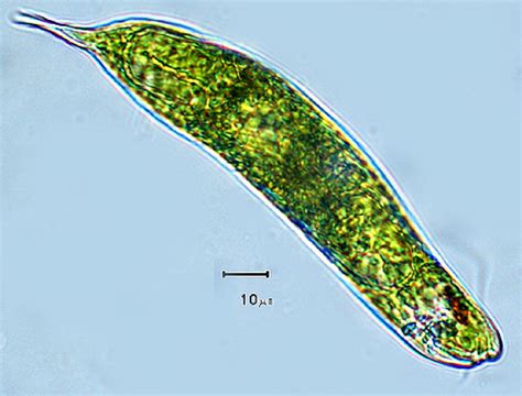 Plant-Like - Kingdom Protista