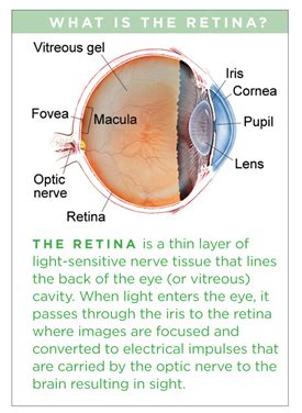 Macular Edema - Patients - The American Society of Retina Specialists