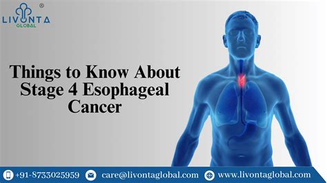 Things to Know About Stage 4 Esophageal Cancer - Livonta Global Pvt Ltd