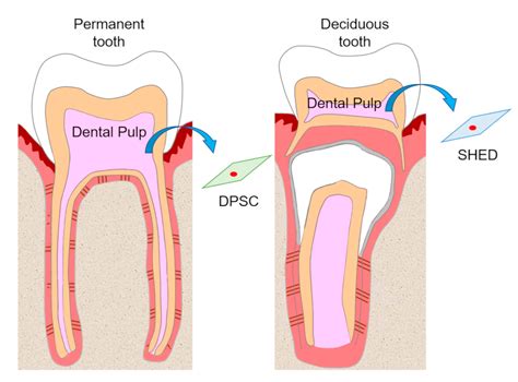 DPSCs in Regenerative Therapy | Encyclopedia MDPI