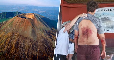 U.S. tourist falls into Mount Vesuvius crater after taking a selfie