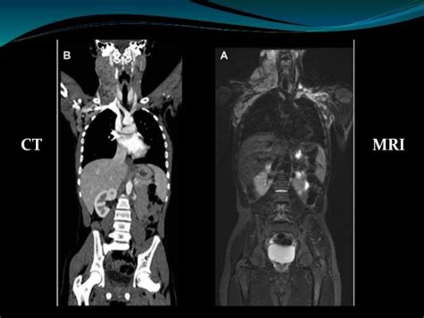 CT Scan Vs MRI Scan