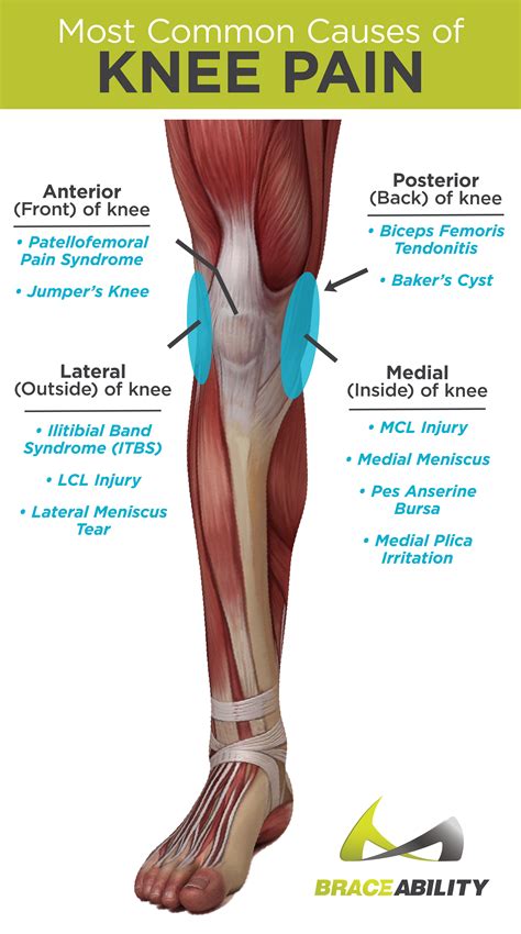 Pin on Massage, Injury and Prevention