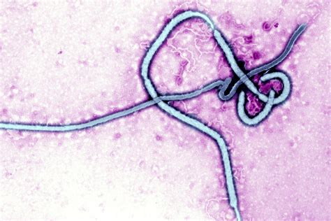 Why Won't The Fear Of Airborne Ebola Go Away? | KBIA