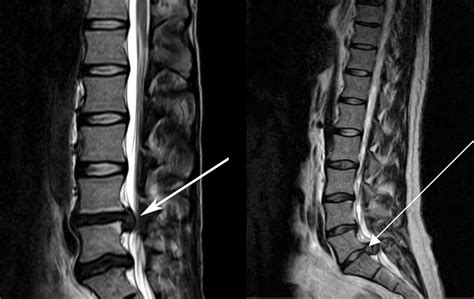 Study Medical Photos: A 40 Year Old Man Presents With Sudden Severe ...