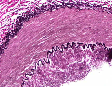 Muscular Artery Vs Elastic Artery Histology