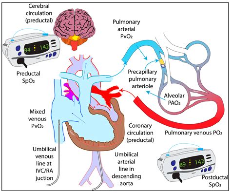 Children | Free Full-Text | How Do We Monitor Oxygenation during the ...