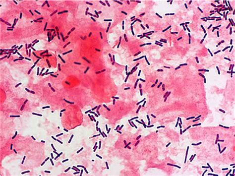 Lactobacillus Lactobacillus spp: cechy, dekodowanie i szybkość